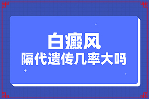 兰州红古区到哪家医院治疗白癜风较专业