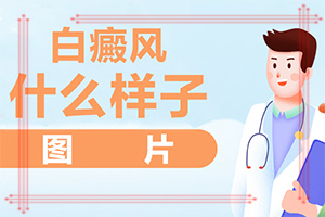 兰州哪家白癜风医院可靠