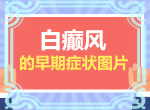 身上长白斑是什么原因引起的图片