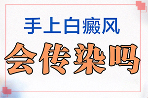 兰州红古区白癜风医院有白癜风的吗