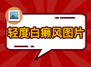 甘肃治疗白癜风的医院哪个值得相信