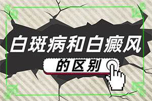 兰州安宁区去哪家治疗白癜风医院好