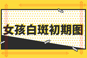 「目光聚集」身上白斑的原因-白颠疯病是怎样形成的