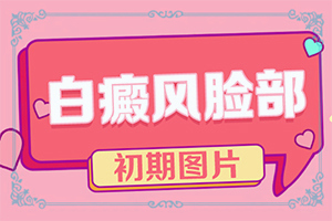 小孩脸上有白色一块是什么原因引起的怎么治疗
