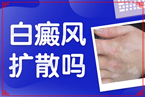看白癜风的兰州专科医院有哪几家