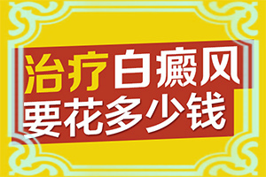 节段型白颠能自愈吗治疗