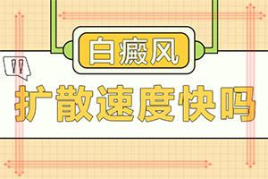 「近期评估」白癜风是如何形成的-为什么会长晕痣白斑