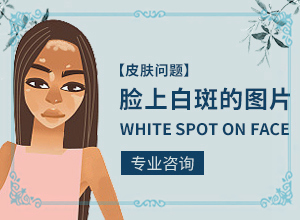 「行动指南」治疗白点癫风的药有哪些图片