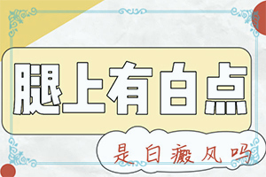 对于白颠治疗偏方要注意什么