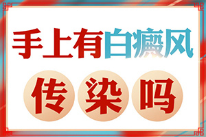 兰州城关区治疗白癜风比较好的医院有哪些