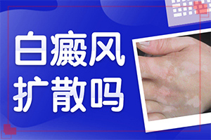 宁夏银川白癜风专科医院有哪些是