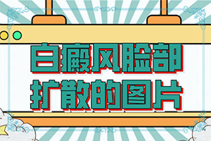 兰州皋兰县去哪家白癜风专科医院比较好
