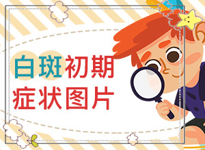 兰州治疗白癜风医院哪个医生厉害