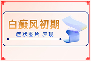 兰州安宁区去哪个白癜风专科医院好