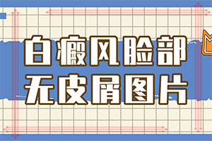 初始早期白癫治疗[专业度]治疗白点癫风最权威医院