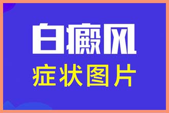 脸上有一小块白的是什么原因呢怎么治疗