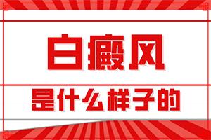 东莞白癜风医院治好大概要花多少钱