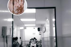 甲泼尼龙片多少钱