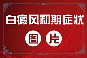 兰州七里河区较好治疗白癜风的医院是哪家