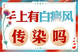 东莞哪个医院治疗儿童白癜风