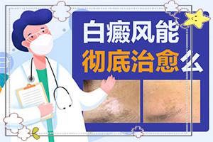 兰州城关区白癜风治疗专业的医院是哪个