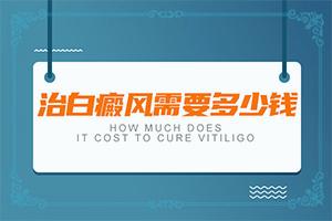 东莞到哪家医院能看好白癜风