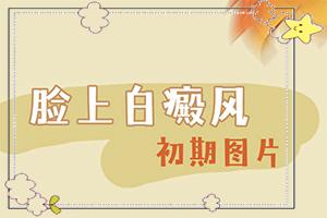 东莞大朗有治疗白癜风的医院吗