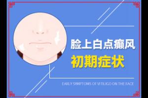 东莞厚街哪里有专门治疗白癜风的医院