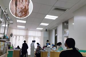 甲泼尼龙琥珀酸钠价格贵吗