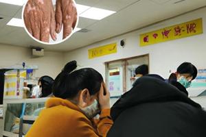 白点癫风背部初期症状有哪些