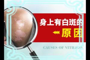东莞一位老中医治疗了我的白斑
