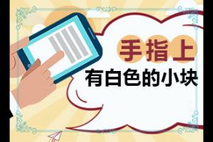 东莞治疗白癜风较好的医院在哪
