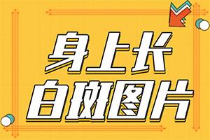 东莞哪个医院治疗儿童白癜风好