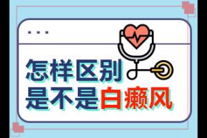 东莞高埗白癜风治疗哪家医院较好