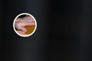 白殿疯病对人体有影响么