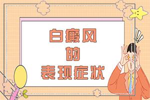 东莞治疗白癜风有没有好的医院
