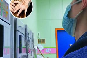 三岁小孩白颠疯病可以恢复吗多少钱