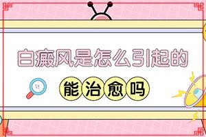 东莞石碣治疗白癜风哪家医院好