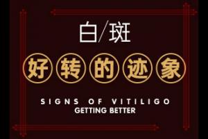 兰州安宁区专门治疗白癜风的医院叫什么