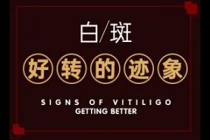 东莞能儿童白癜风的医院