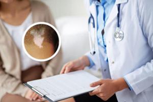 甲泼尼龙主要治啥