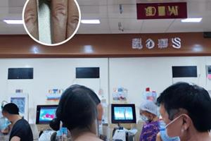 贞芪扶正颗粒无糖型