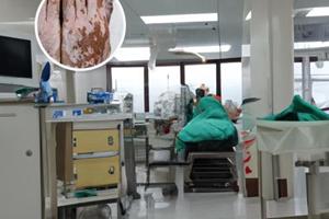 甲泼尼龙片价格