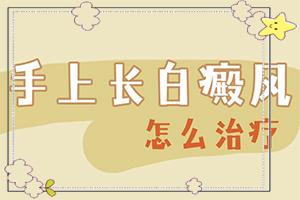 治疗白殿疯东莞哪家医院好-东莞治疗白癜风医院哪个较好
