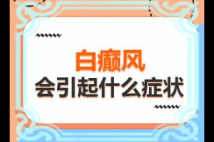 东莞哪家医院治疗儿童白癜风