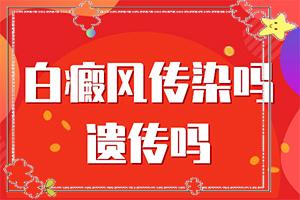 东莞有能白癜风的专科吗