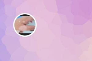 手上的白殿风怎么办