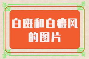 东莞女性要吃什么才能增加黑色素