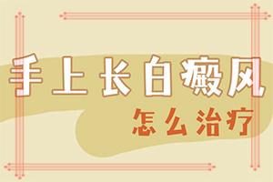 东莞白癫风医院哪家较好-白班病给会传染