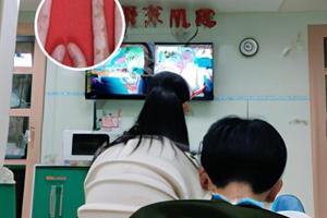 白风癫是怎么得的